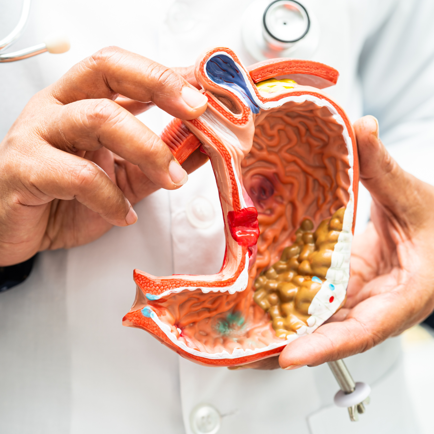 Top 5 des meilleures fiches mémo pour les aides-soignants