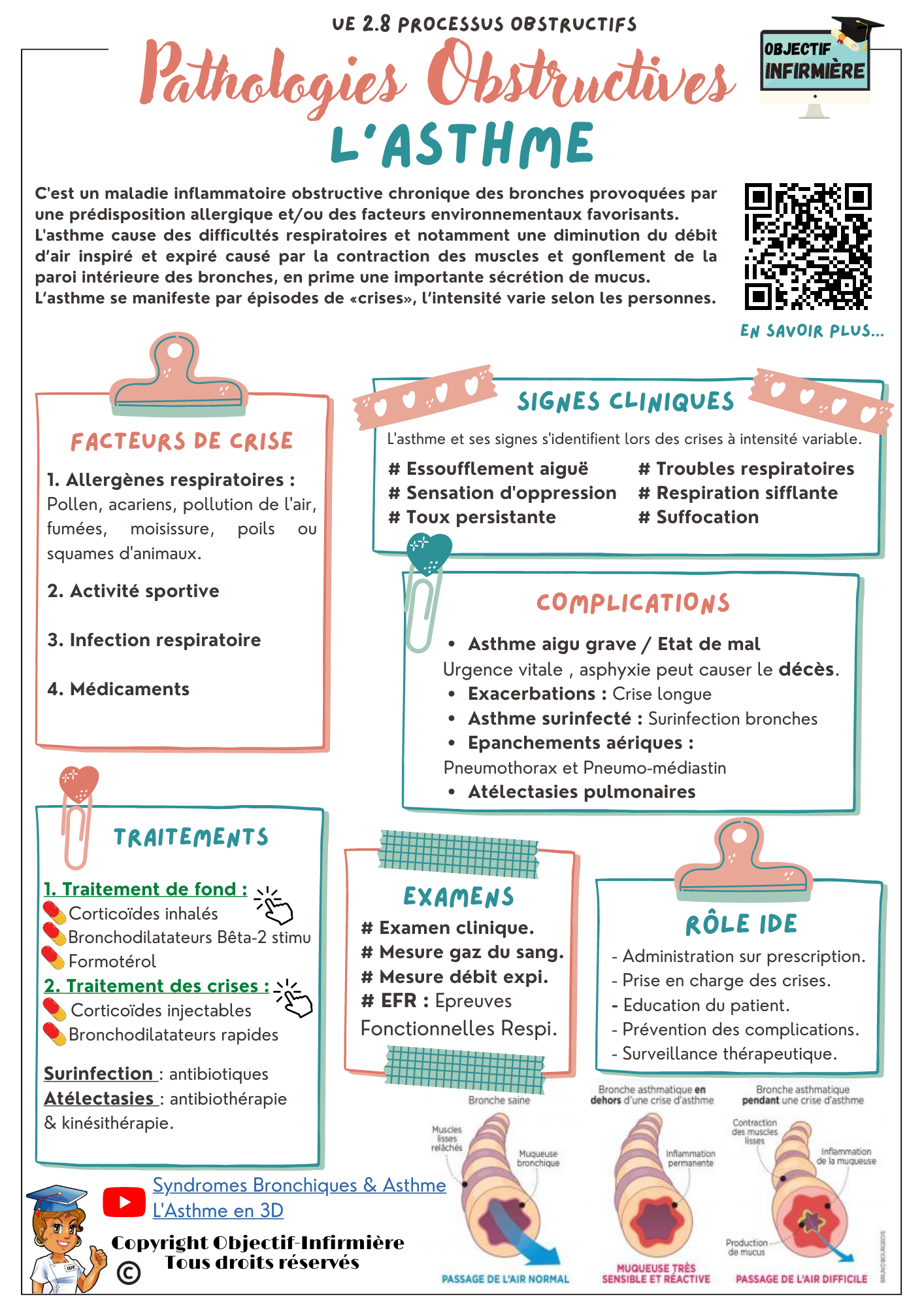Guide Pathologies Obstructives AS & IDE UE 2.8 Processus Obstructifs fiches mémo